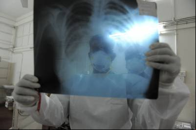 A influenza A (H1N1) é um subtipo do influenzavírus A e a causa mais comum de gripe em seres humanos - (crédito: SAM PANTHAKY) A influenza A (H1N1) é um subtipo do influenzavírus A e a causa mais comum de gripe em seres humanos - (crédito: SAM PANTHAKY)