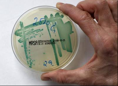 1,2 milhão de pessoas morreram por infecções causadas por superbactérias em 2019