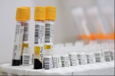Doença de Parkinson poderá ser diagnosticada por exame de sangue simples